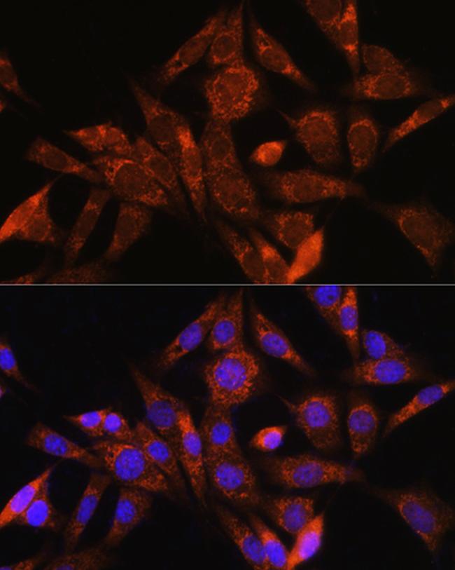 Angiogenin Antibody in Immunocytochemistry (ICC/IF)