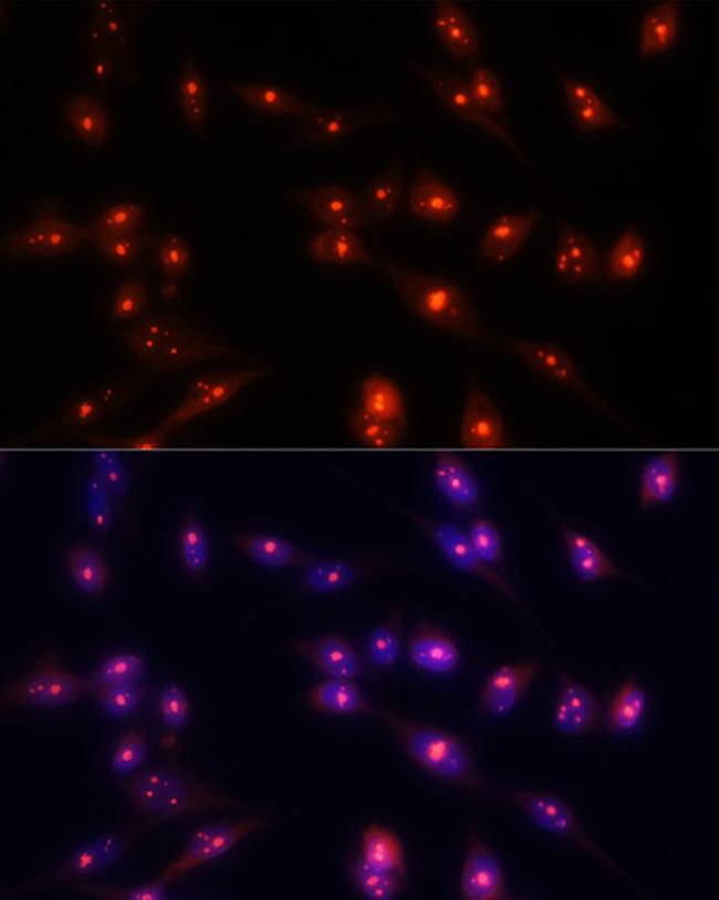 Fibrillarin Antibody in Immunocytochemistry (ICC/IF)