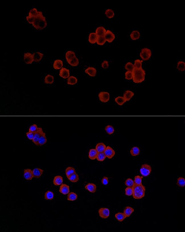 Lysozyme Antibody in Immunocytochemistry (ICC/IF)