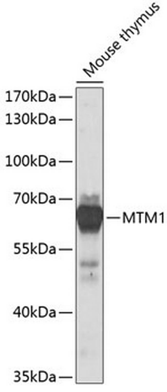 MTM1 Antibody in Western Blot (WB)