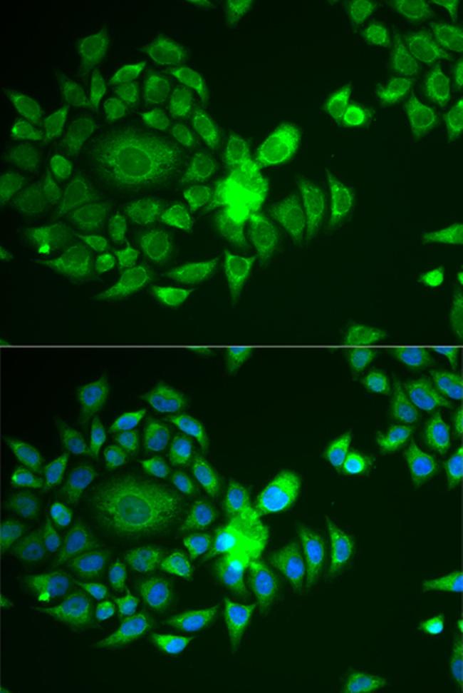 NDUFS4 Antibody in Immunocytochemistry (ICC/IF)