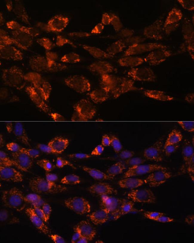 MAOA Antibody in Immunocytochemistry (ICC/IF)