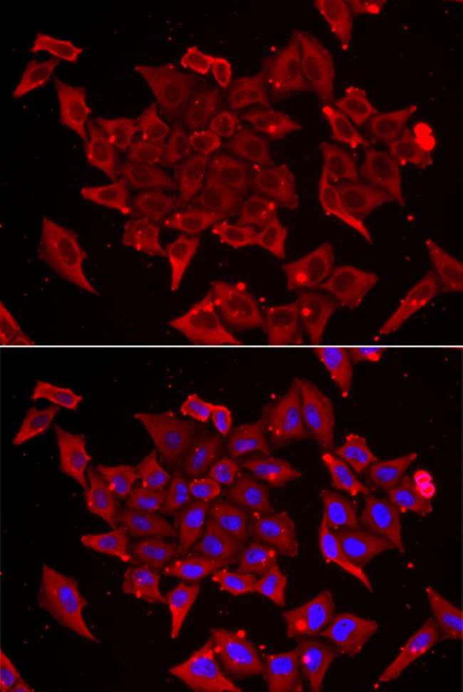 TIM17 Antibody in Immunocytochemistry (ICC/IF)