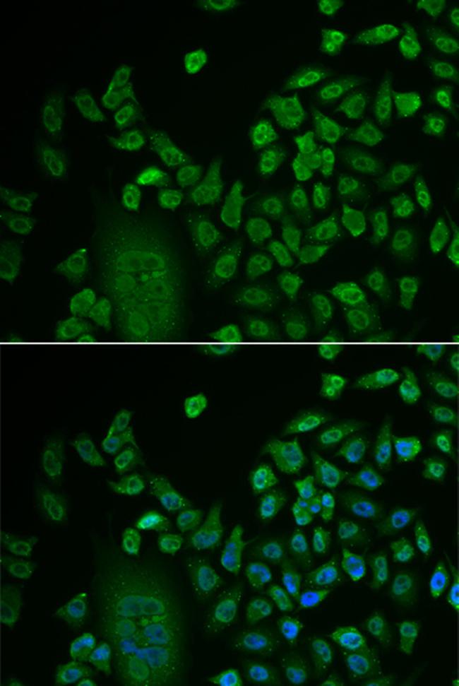 LSM4 Antibody in Immunocytochemistry (ICC/IF)