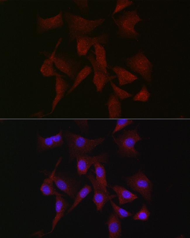 PKC beta Antibody in Immunocytochemistry (ICC/IF)