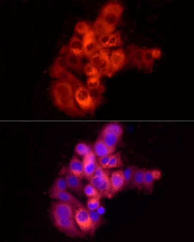 Albumin Antibody in Immunocytochemistry (ICC/IF)