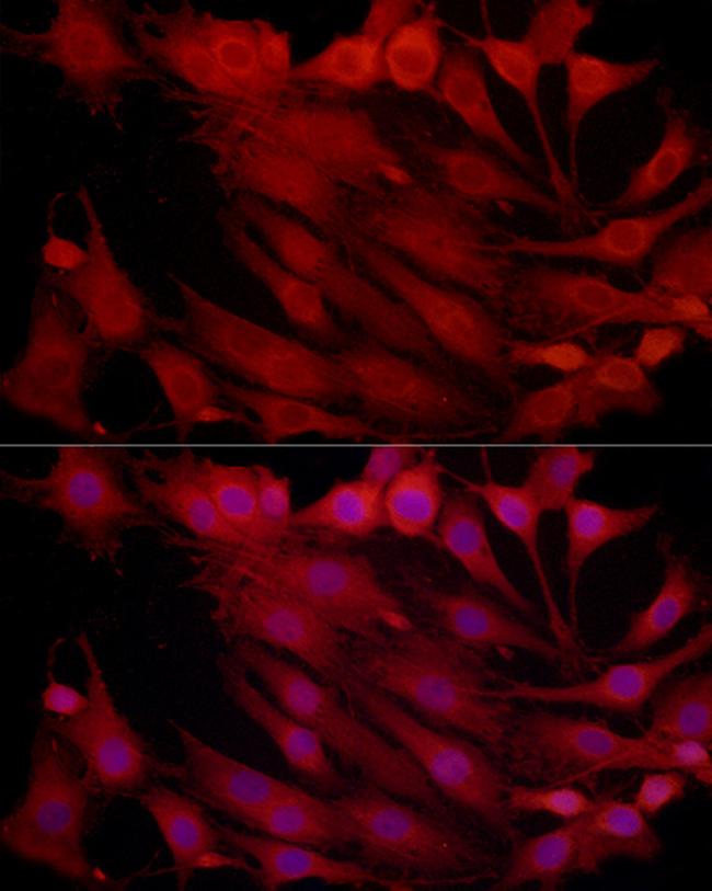 PSMB2 Antibody in Immunocytochemistry (ICC/IF)