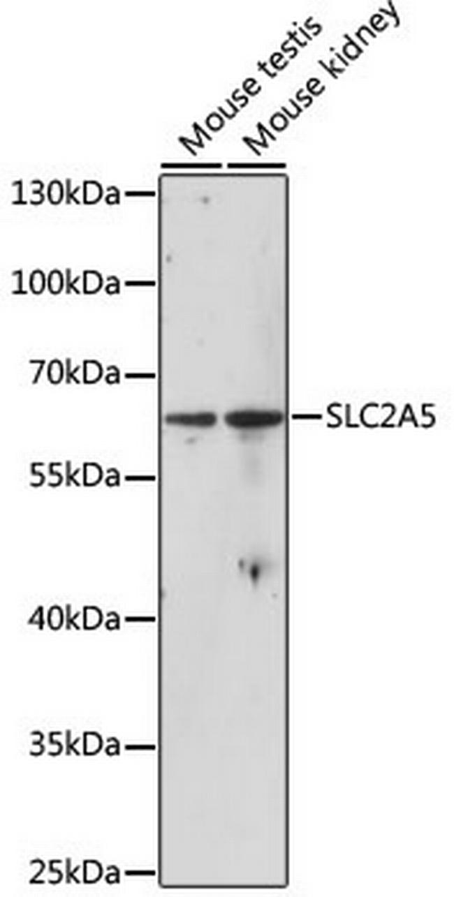 GLUT5 Antibody in Western Blot (WB)