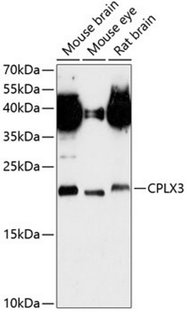 CPLX3 Antibody in Western Blot (WB)