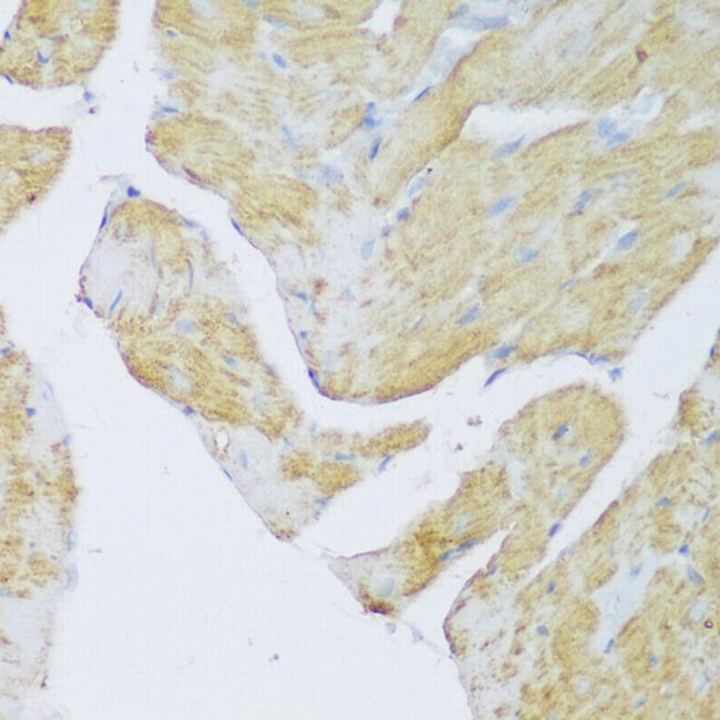 DENR Antibody in Immunohistochemistry (Paraffin) (IHC (P))