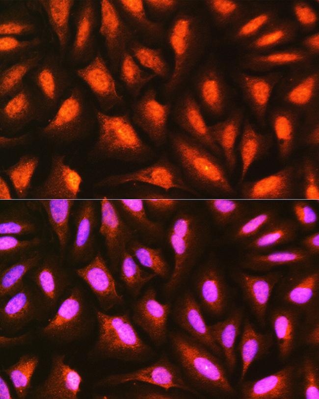 MDFI Antibody in Immunocytochemistry (ICC/IF)