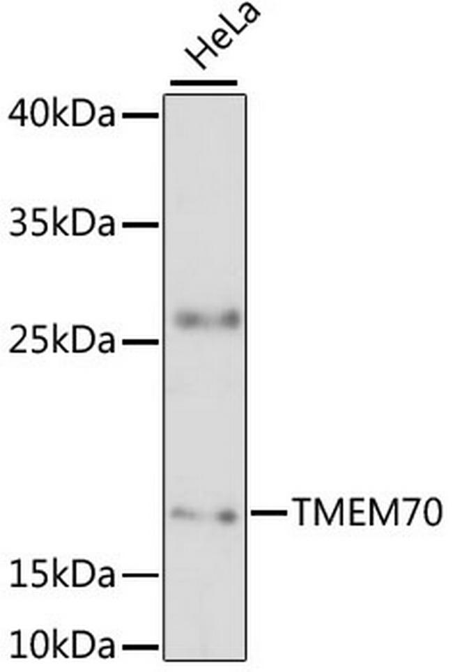 TMEM70 Antibody in Western Blot (WB)