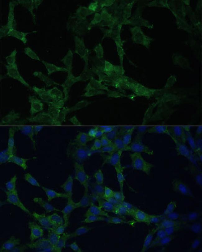 CAMLG Antibody in Immunocytochemistry (ICC/IF)