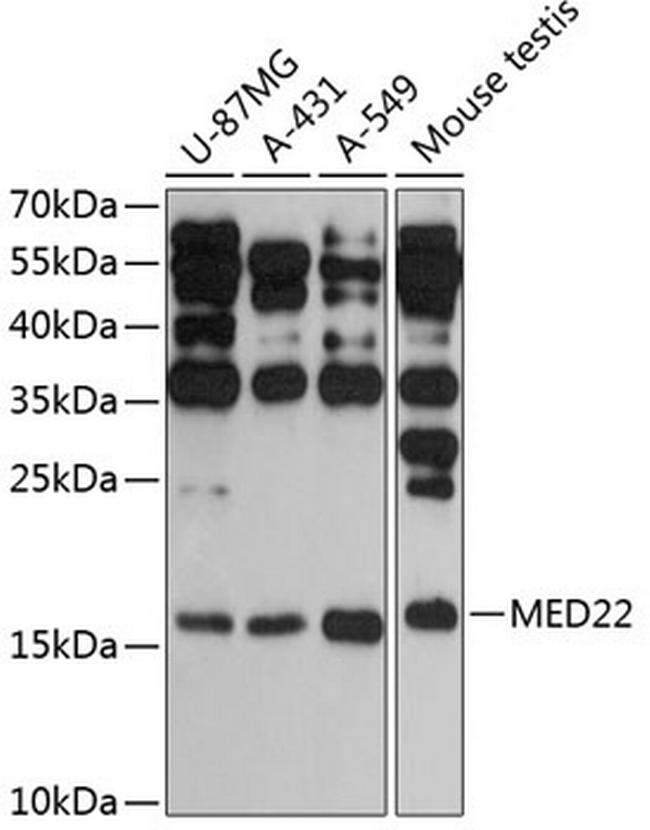 MED22 Antibody in Western Blot (WB)