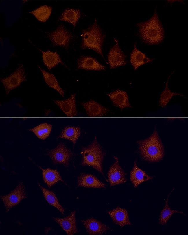 CPT1C Antibody in Immunocytochemistry (ICC/IF)