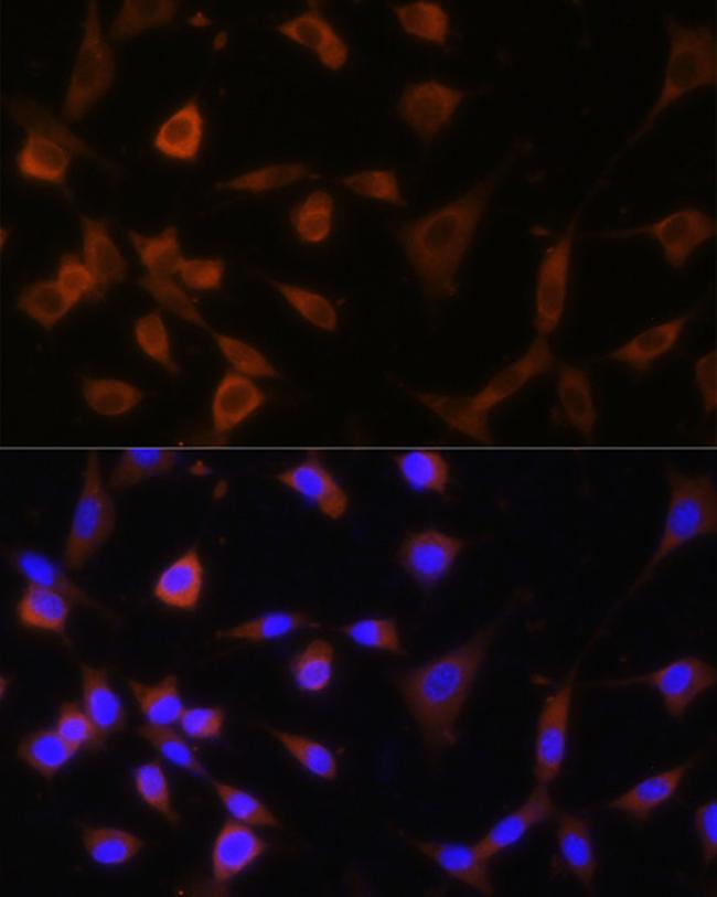 GANAB Antibody in Immunocytochemistry (ICC/IF)