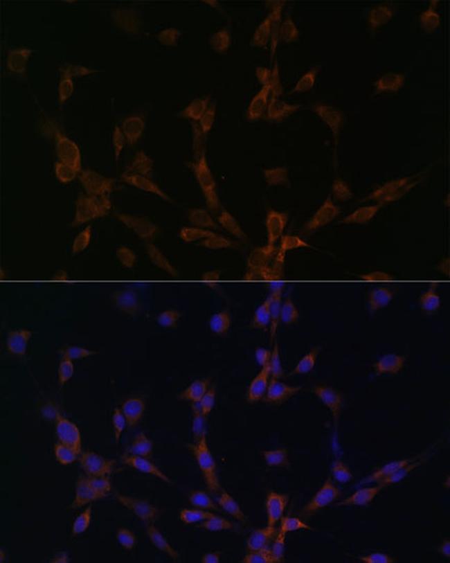 Dynein Antibody in Immunocytochemistry (ICC/IF)