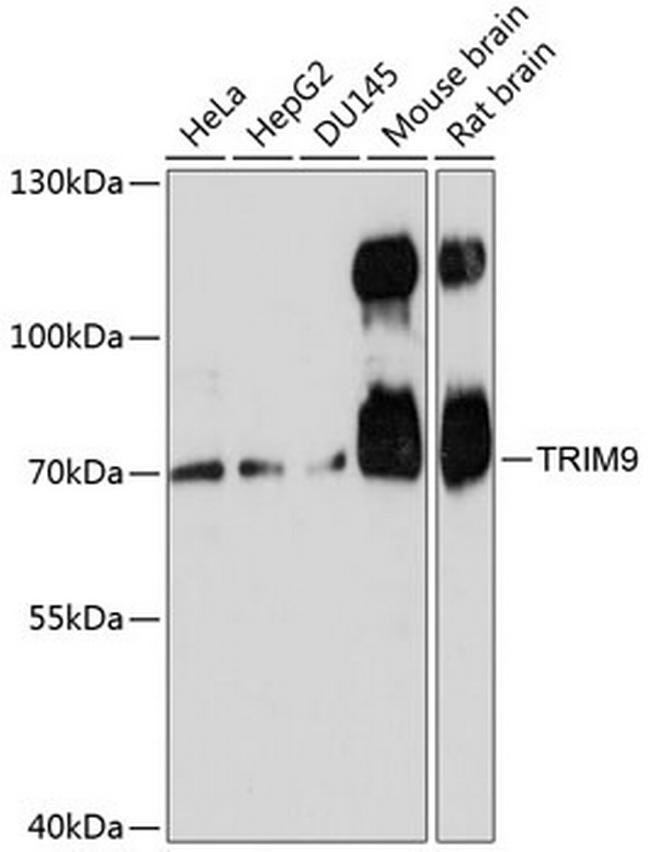 TRIM9 Antibody in Western Blot (WB)