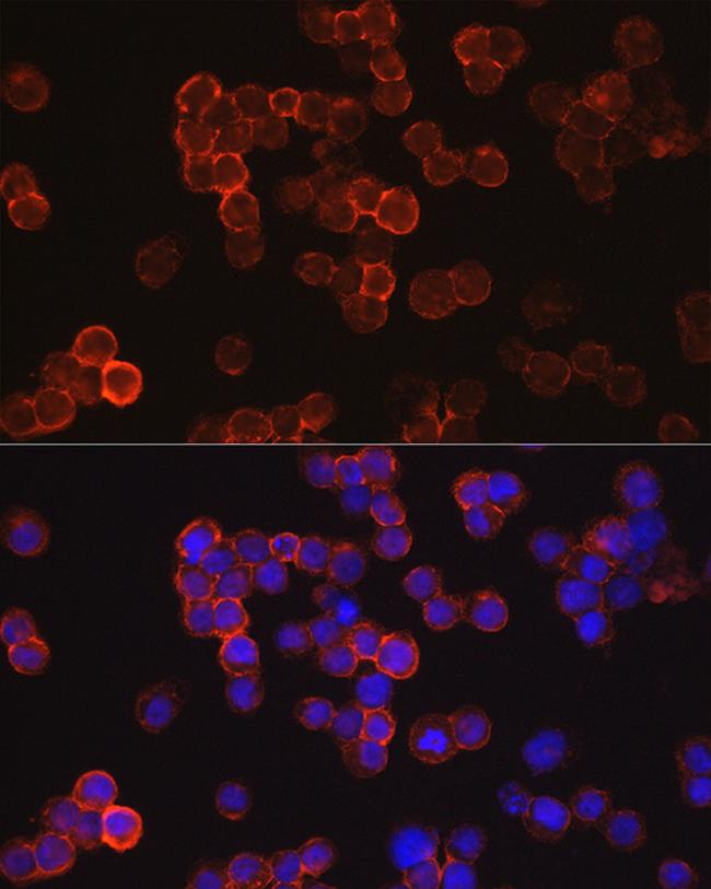 CD34 Antibody in Immunocytochemistry (ICC/IF)