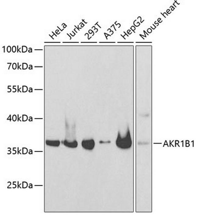 AKR1B1 Antibody in Western Blot (WB)