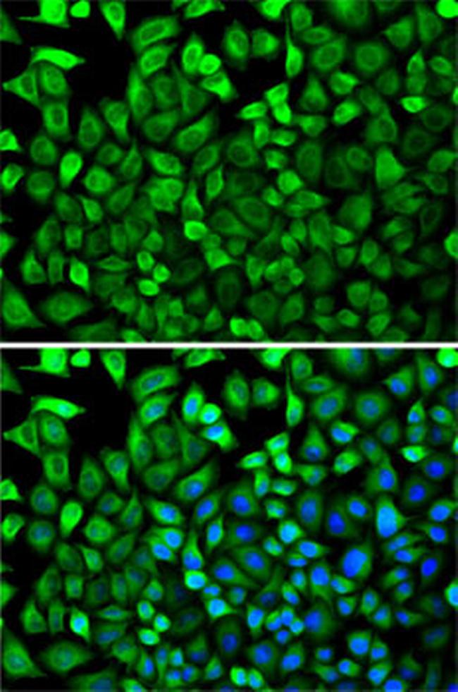 CDA Antibody in Immunocytochemistry (ICC/IF)