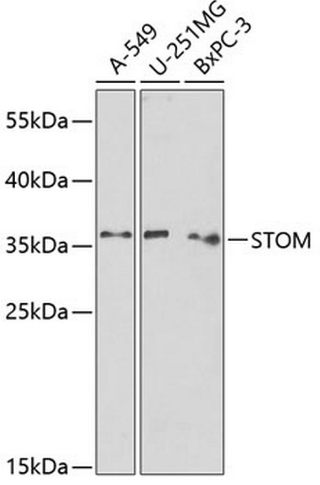 Stomatin Antibody in Western Blot (WB)