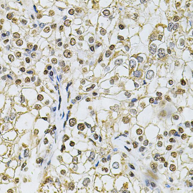 IFI16 Antibody in Immunohistochemistry (Paraffin) (IHC (P))