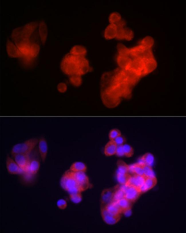 FIBB Antibody in Immunocytochemistry (ICC/IF)