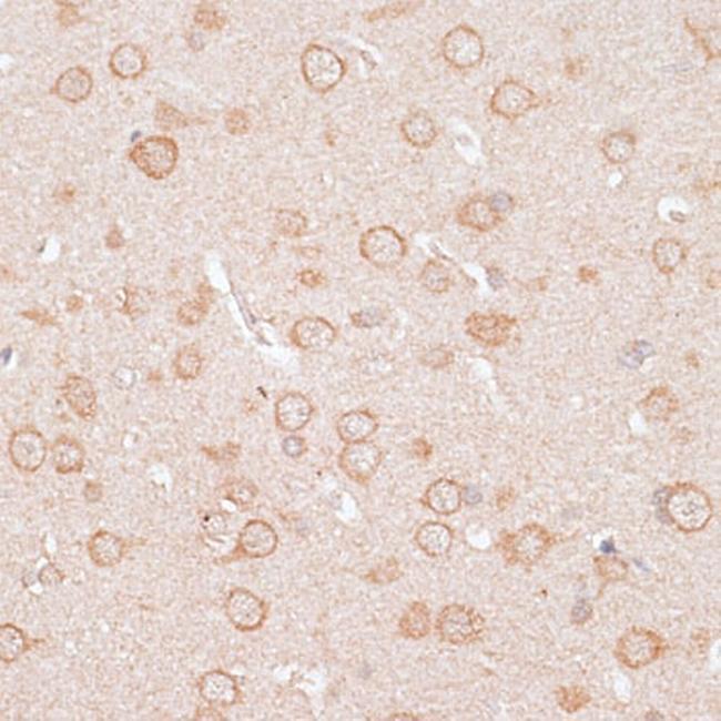 Kir2.3 (KCNJ4) Antibody in Immunohistochemistry (Paraffin) (IHC (P))