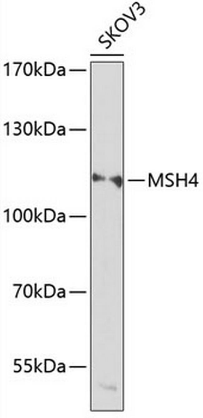 MSH4 Antibody in Western Blot (WB)