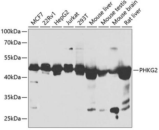 PHKG2 Antibody in Western Blot (WB)