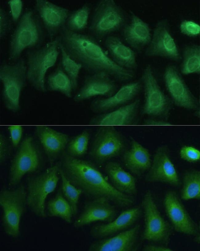 PTPN22 Antibody in Immunocytochemistry (ICC/IF)