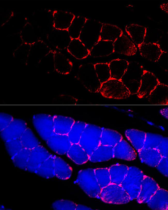 Dystrophin Antibody in Immunocytochemistry (ICC/IF)