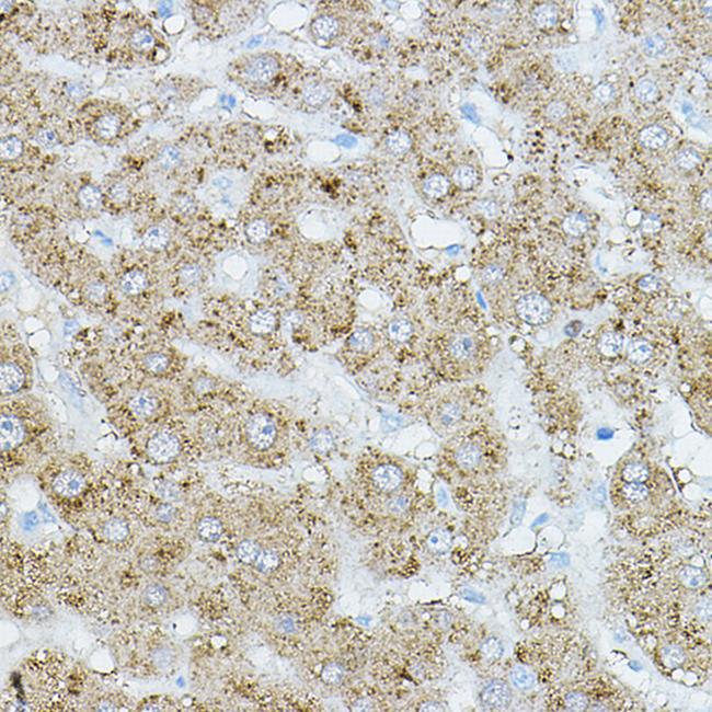 HRI Antibody in Immunohistochemistry (Paraffin) (IHC (P))