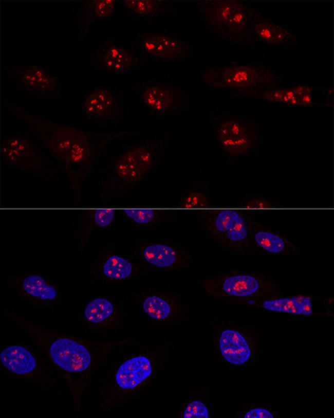 NOP58 Antibody in Immunocytochemistry (ICC/IF)