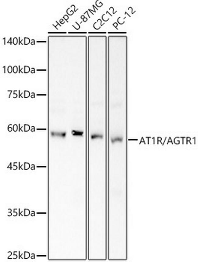 AGTR1 Antibody in Western Blot (WB)