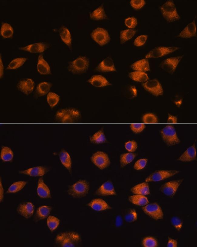 EphA5 Antibody in Immunocytochemistry (ICC/IF)