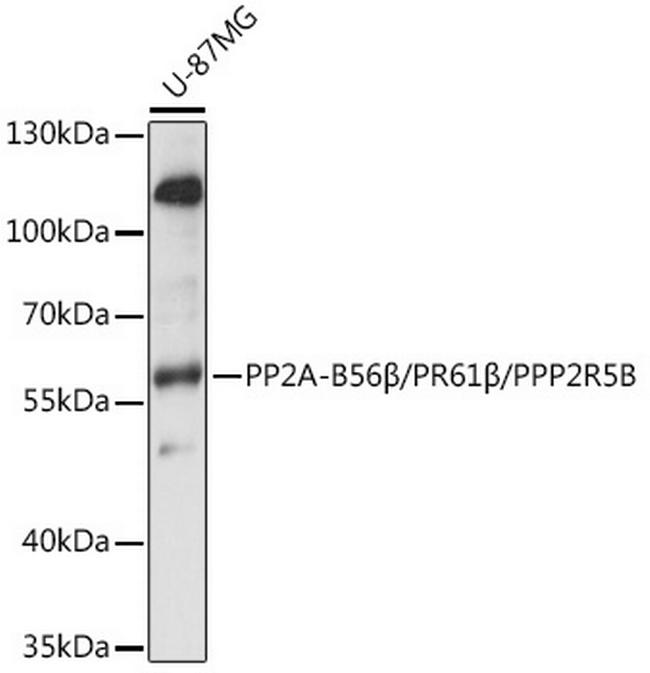 PPP2R5B Antibody in Western Blot (WB)