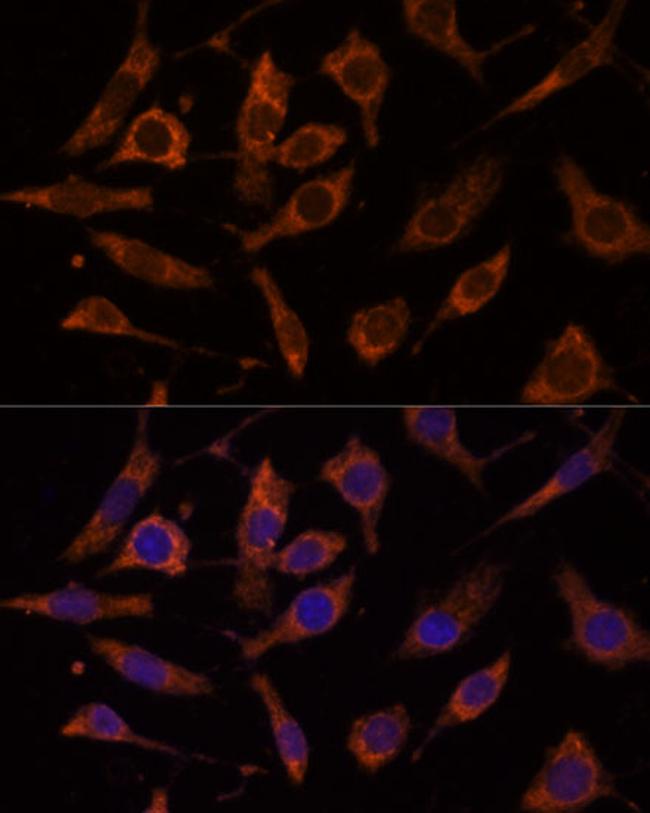 RPL24 Antibody in Immunocytochemistry (ICC/IF)