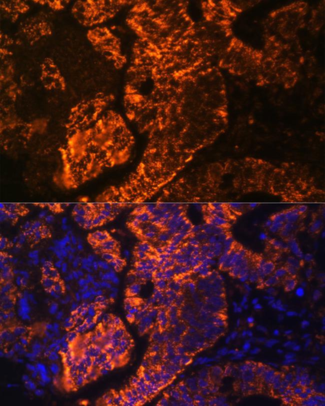 DR3 Antibody in Immunocytochemistry (ICC/IF)