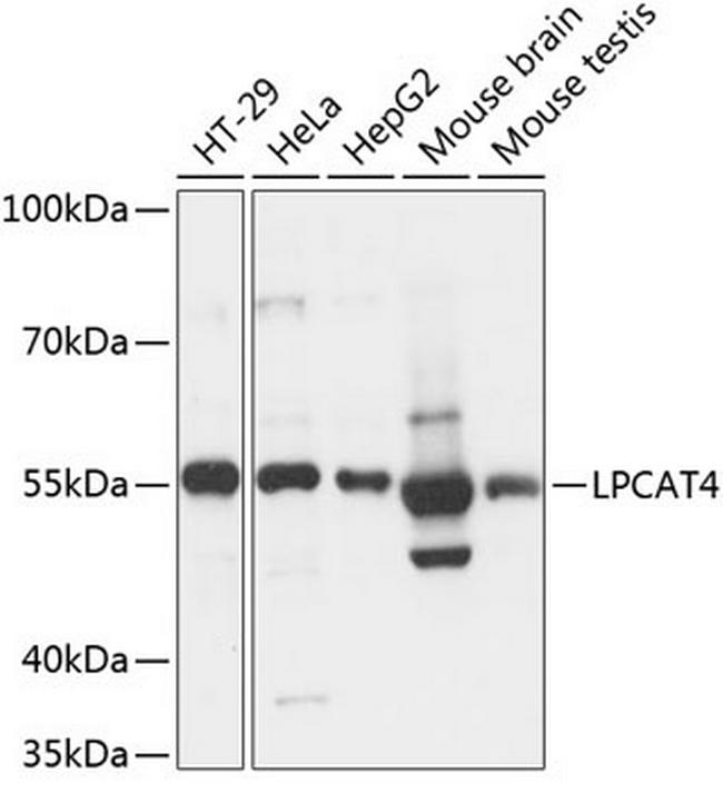 LPCAT4 Antibody in Western Blot (WB)