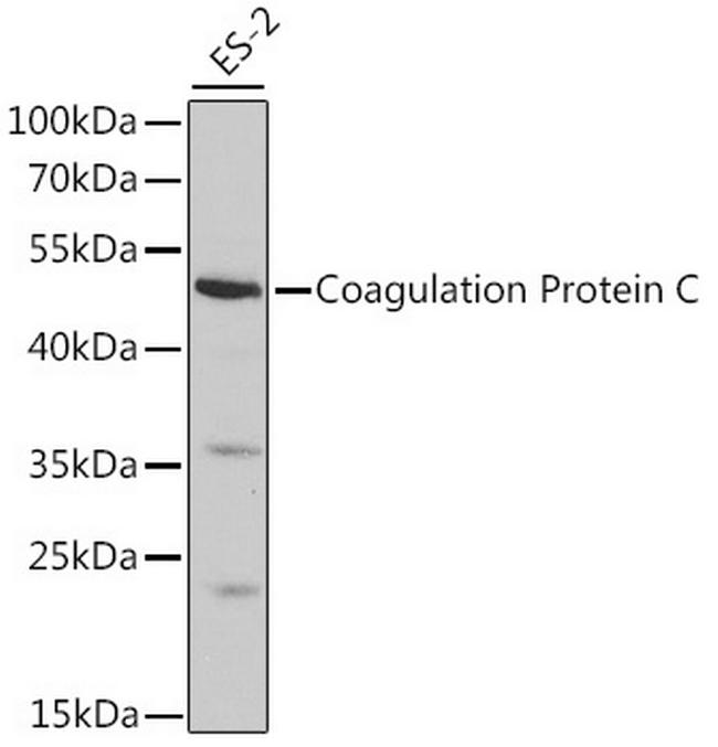 Protein C Antibody in Western Blot (WB)