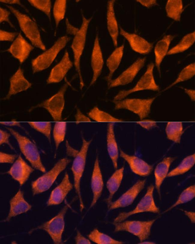 LHPP Antibody in Immunocytochemistry (ICC/IF)