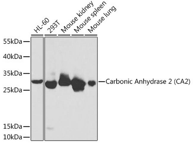 Carbonic Anhydrase II Antibody in Western Blot (WB)