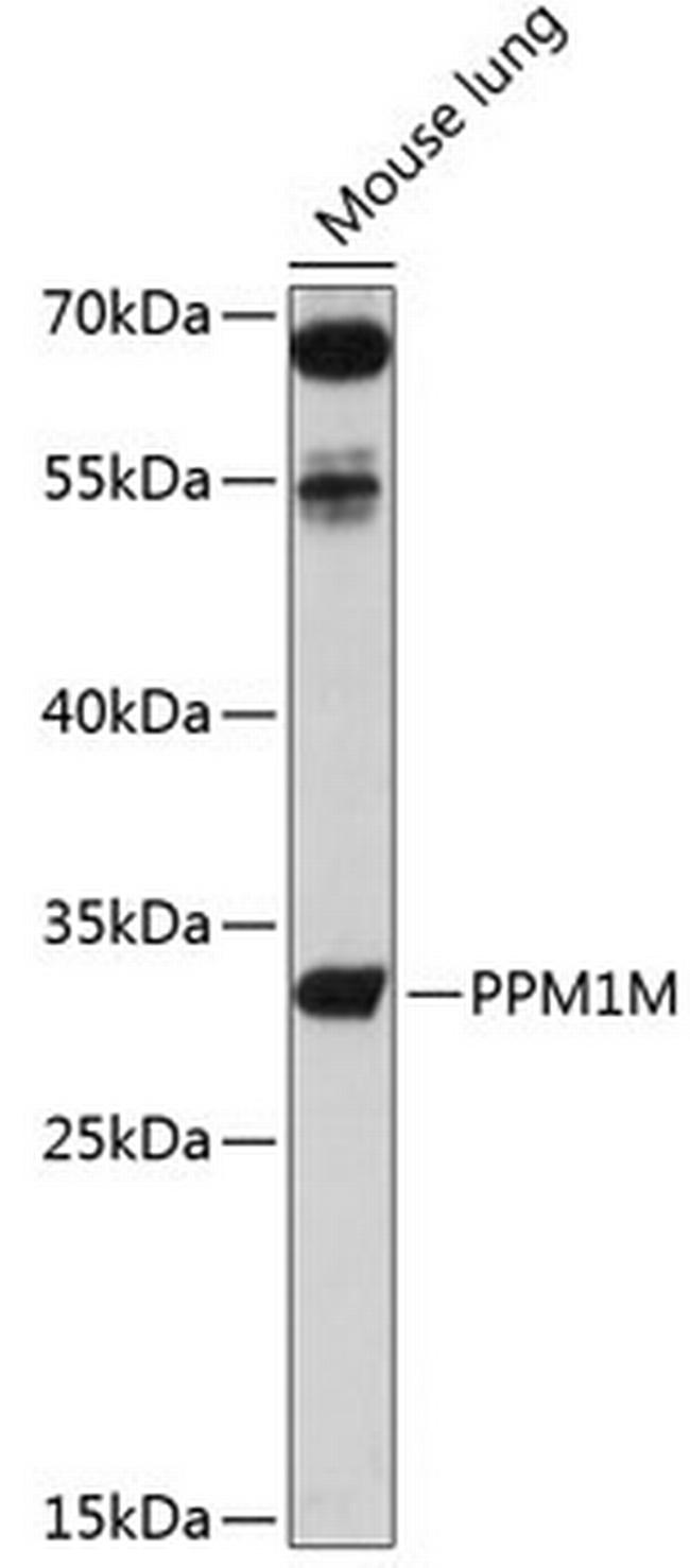 PPM1E Antibody in Western Blot (WB)