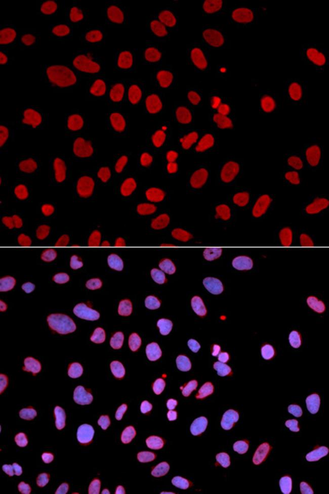 SHP-1 Antibody in Immunocytochemistry (ICC/IF)