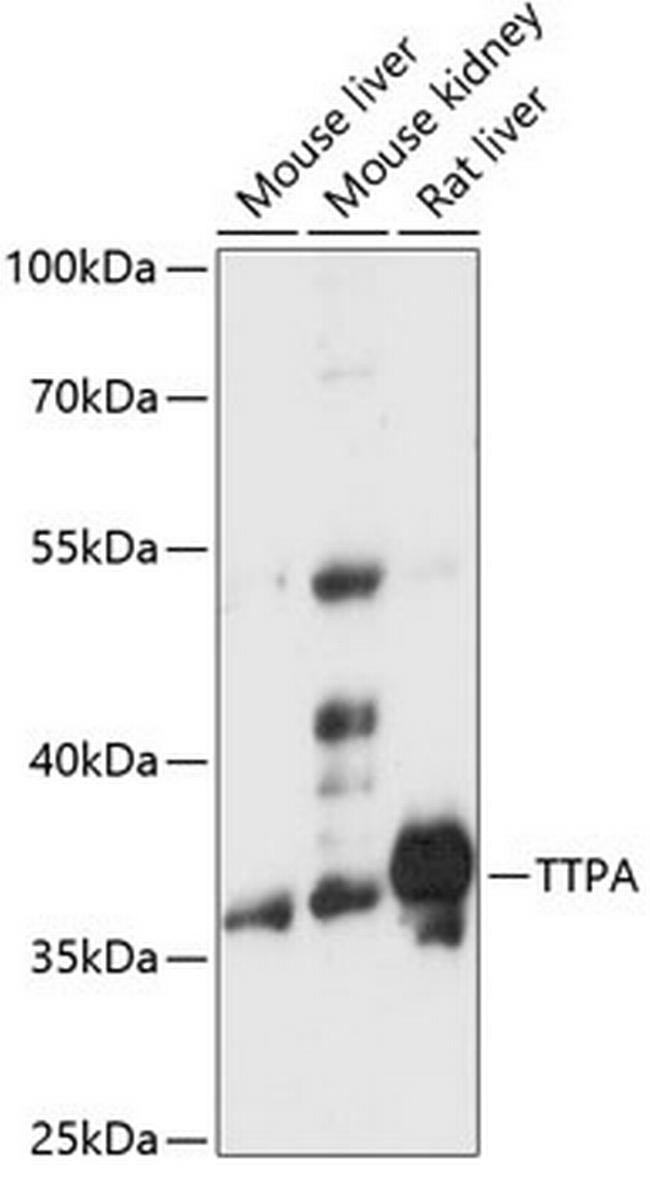 alpha TTP Antibody in Western Blot (WB)