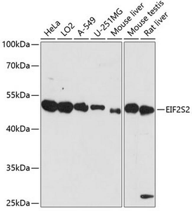 eIF2 beta Antibody in Western Blot (WB)