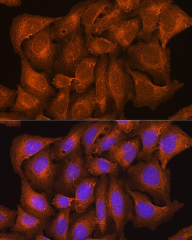 Nicastrin Antibody in Immunocytochemistry (ICC/IF)