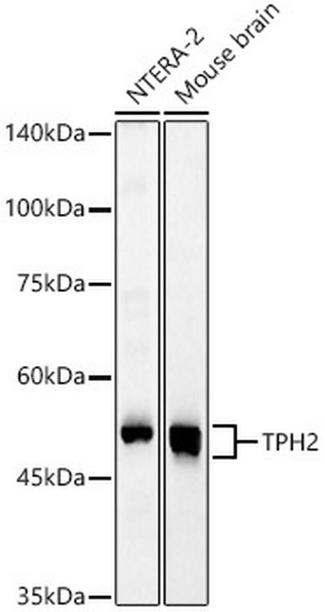 TPH2 Antibody in Western Blot (WB)